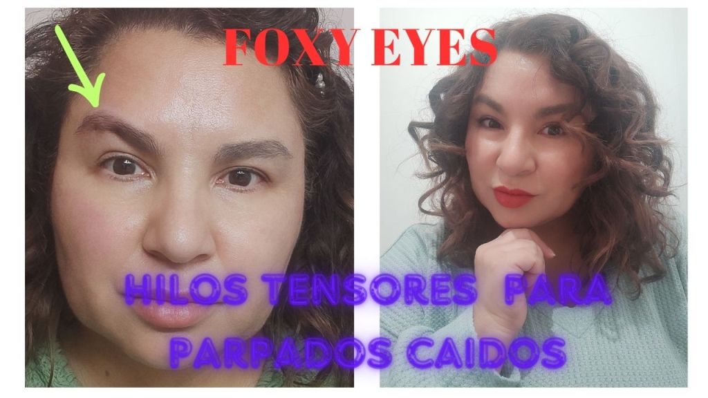 FOXY EYES, REJUVENECE TU MIRADA, CORRIGUE EL PARPADO CAIDO Hilos&nbsp;Tensores