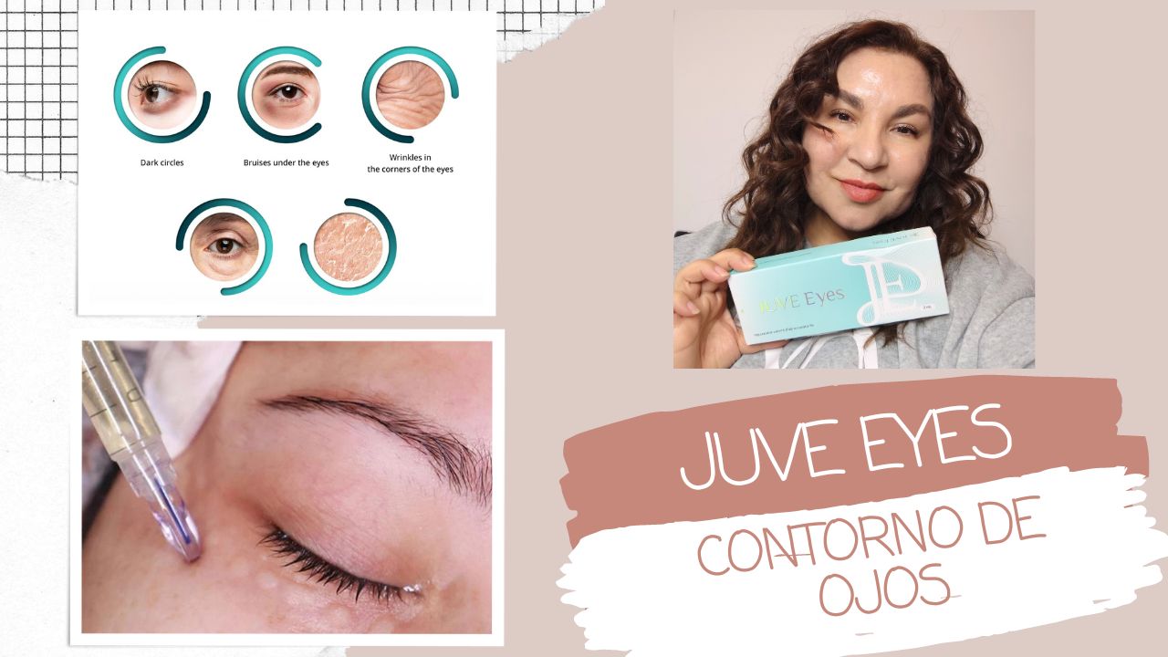 Juve Eyes: Mesoterapia Inyectable para la Juventud de tu contorno de ojos