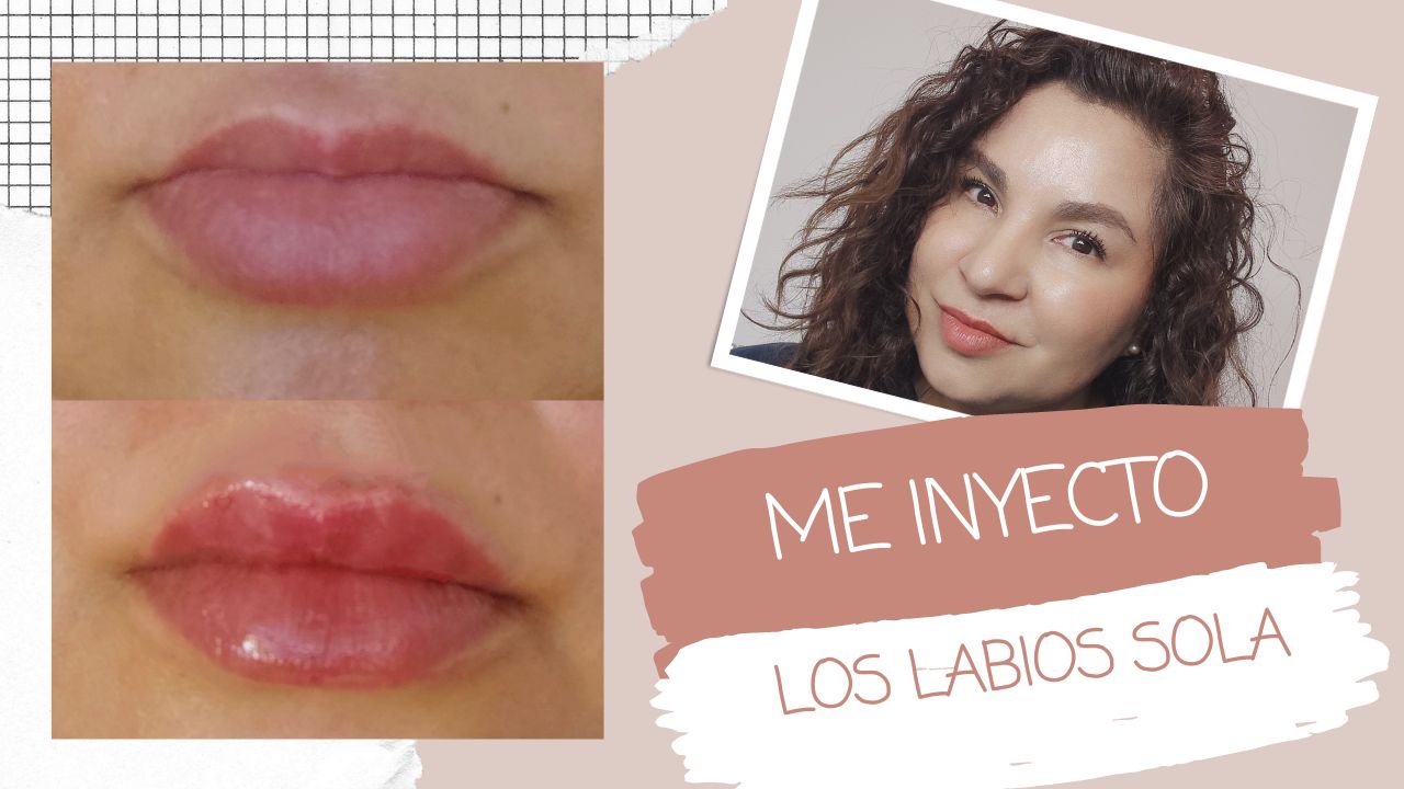 COMO INYECTO MIS LABIOS DE MANERA SEGURA PASO A PASO