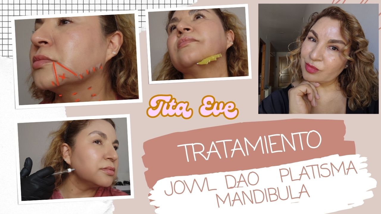 Guía Completa para Jowl, Platisma y Mandíbula EFICACES PARA OVALO FACIAL REJUVENECIDO