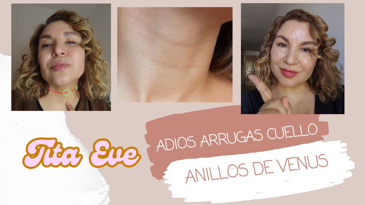 COMO ELIMINAR ARRUGAS DEL CUELLO, ANILLOS DE VENUS, TRATAMIENTO