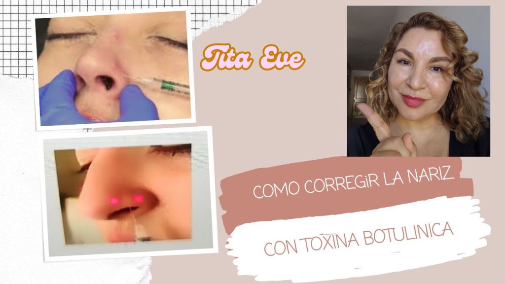 Cómo corregir arrugas y forma de la nariz con&nbsp;Botox