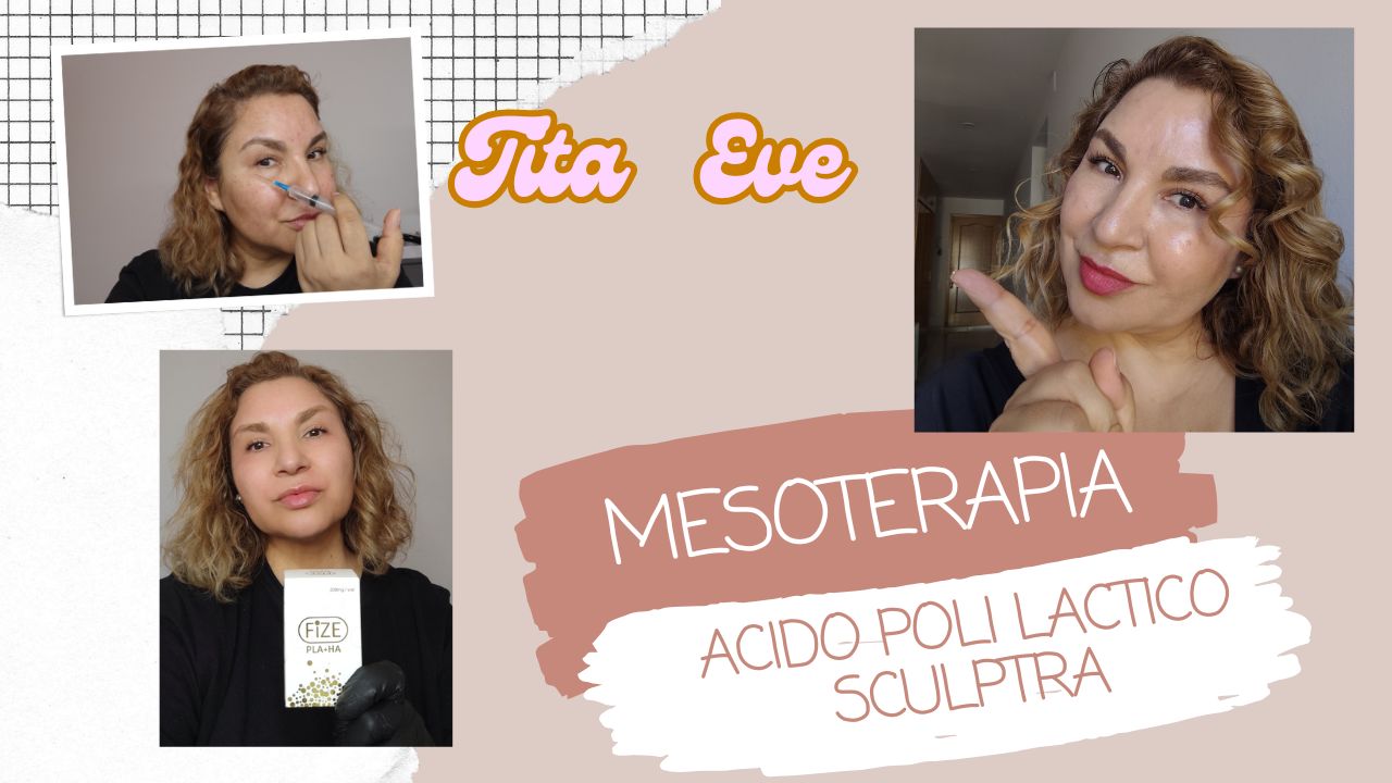 Mesoterapia con Ácido Poli Láctico, Sculptra o Fize Pla+Ah, Paso a paso y beneficios