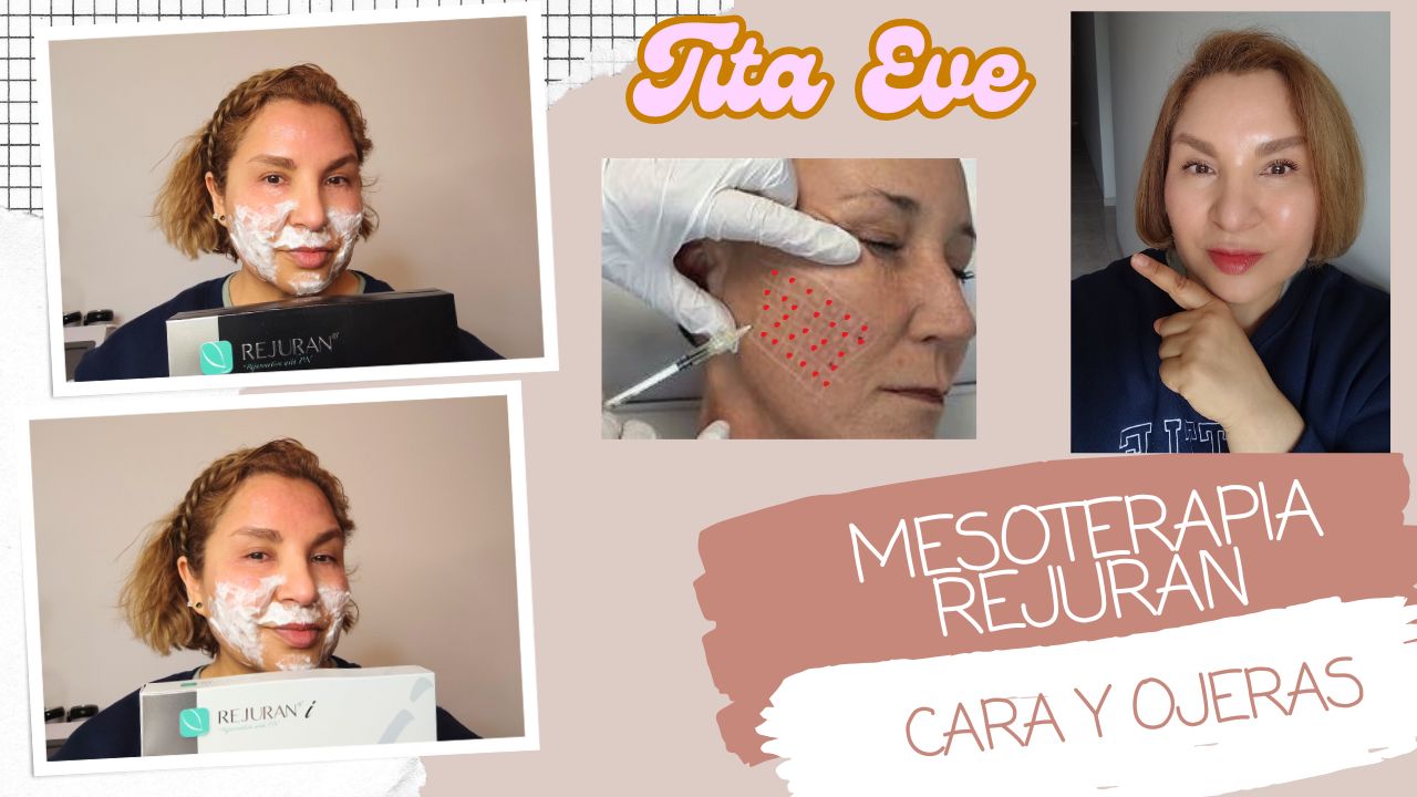 Rejuvenecimiento Facial con Polinucleótidos: Beneficios y Productos