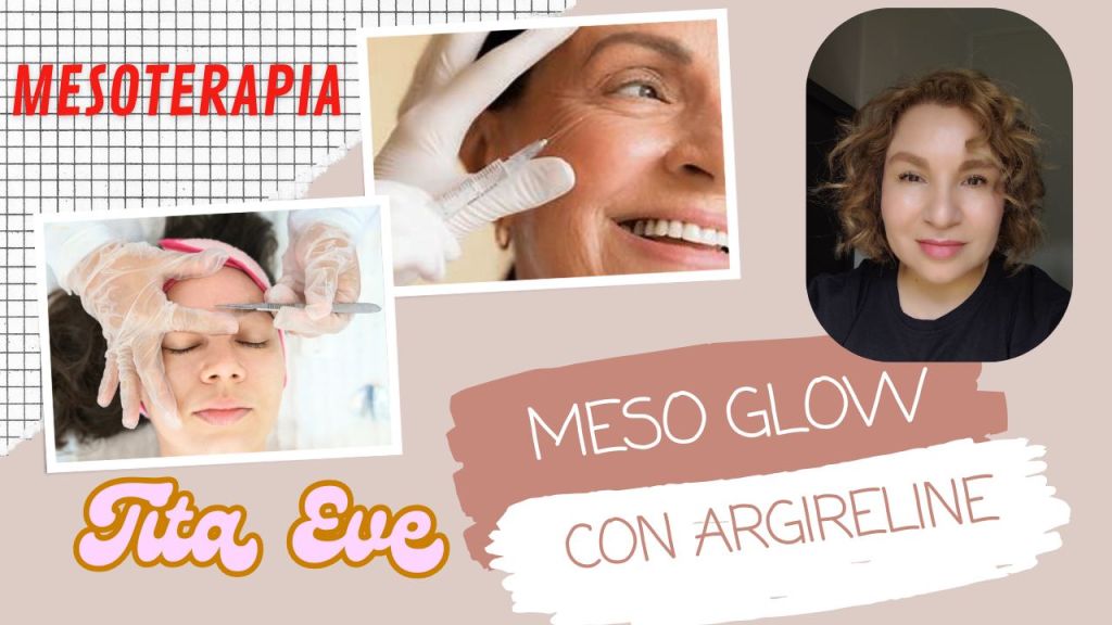 Alternativa a la Toxina Botulínica: Glow en Tu&nbsp;Piel