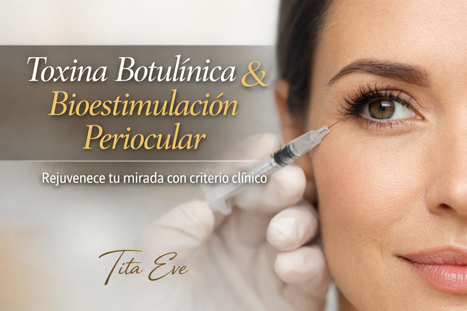 Toxina botulínica y bioestimulación periocular